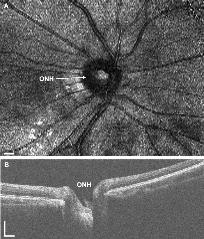 Fig. 13