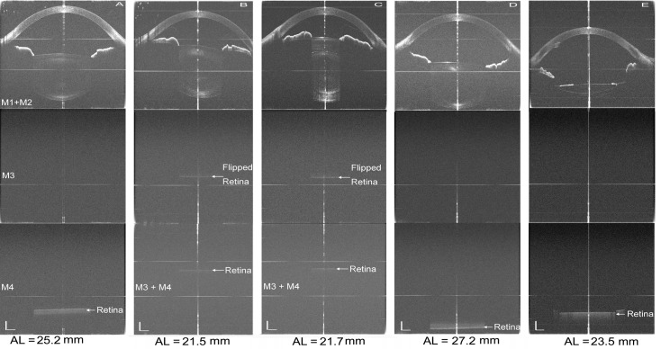 Fig. 11