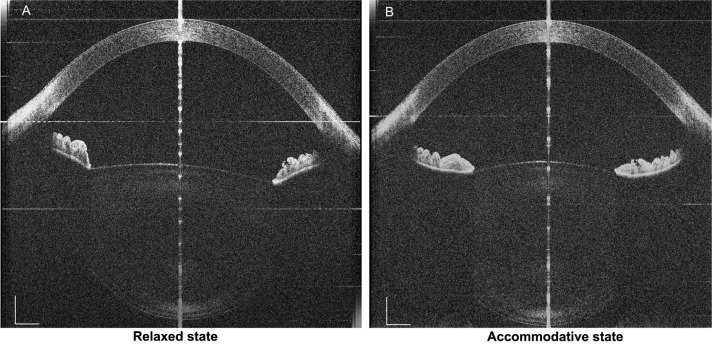 Fig. 10