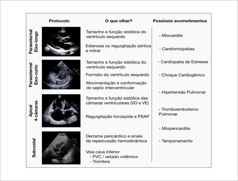 Figura 4