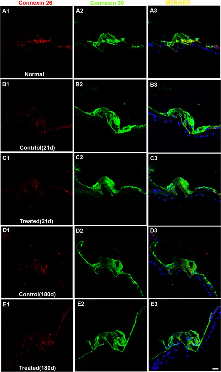 Fig 12