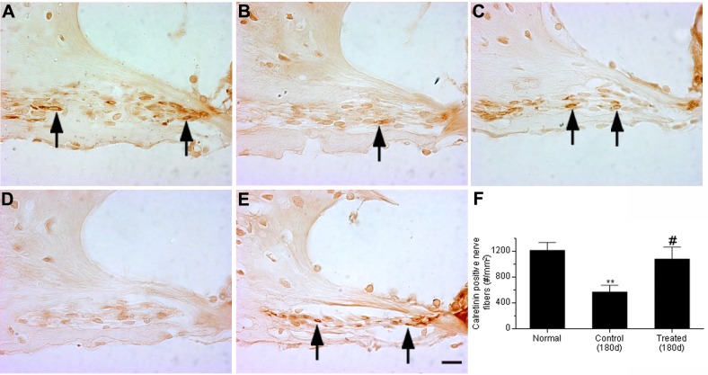 Fig 11