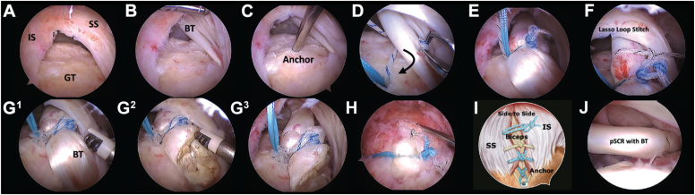 Figure 4