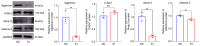 Figure 3. Anabolic and catabolic changes after Reg3 β knockdown. Aggrecan, Mmp13 and Adamts–5 were downregulated, whereas Col2a1 exhibited no obvious change. Student's t-tests were performed to evalua...