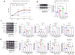 Figure 5. Recombinant Reg3 β protein promotes the activity of chondrocytes and the metabolism of the extracellular matrix. (A) The optimum concentration of recombinant Reg3 β protein for subsequent ex...