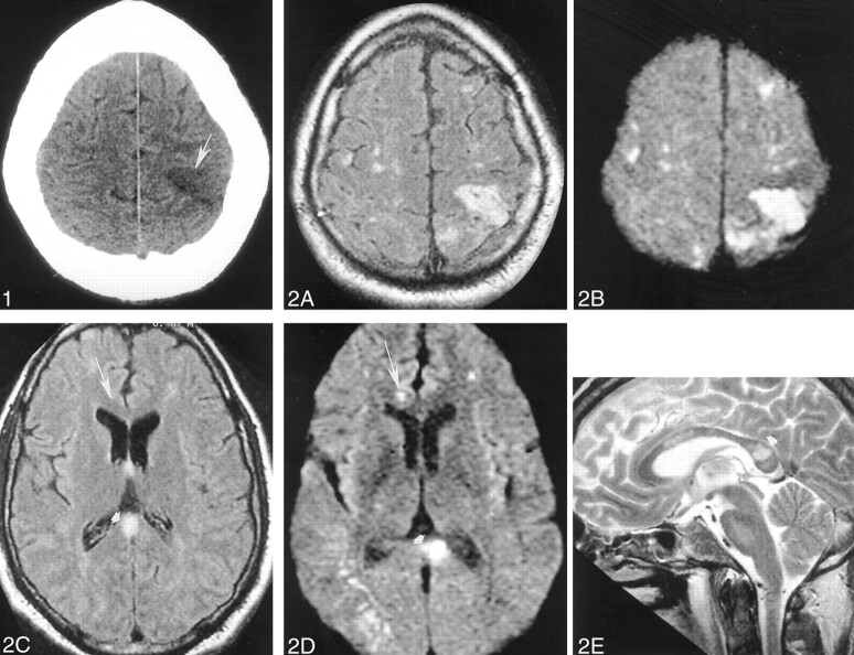 Fig 2.