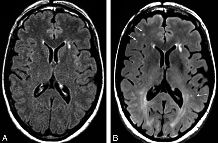 Fig 1.