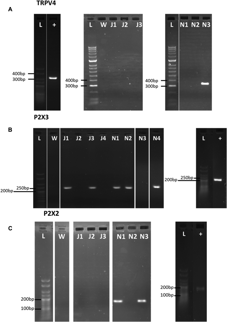 Fig E3