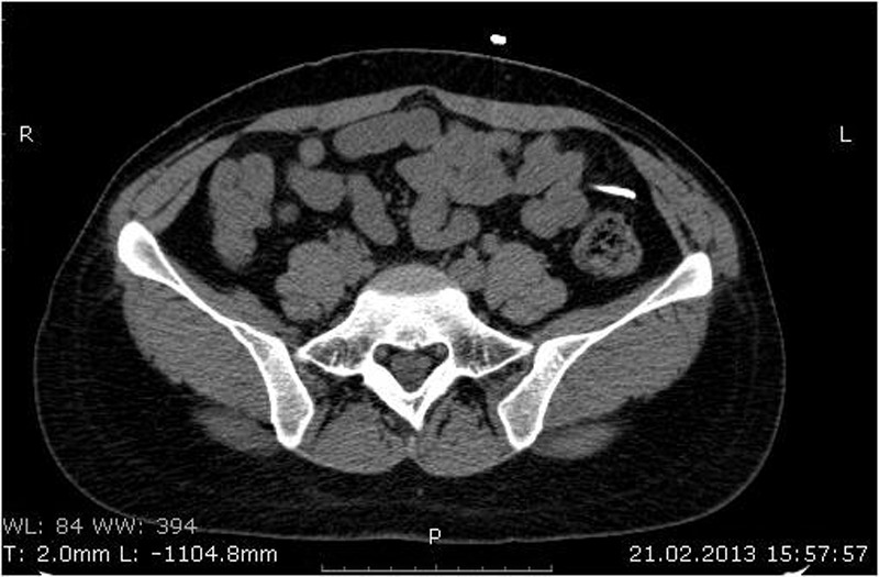 Figure 4