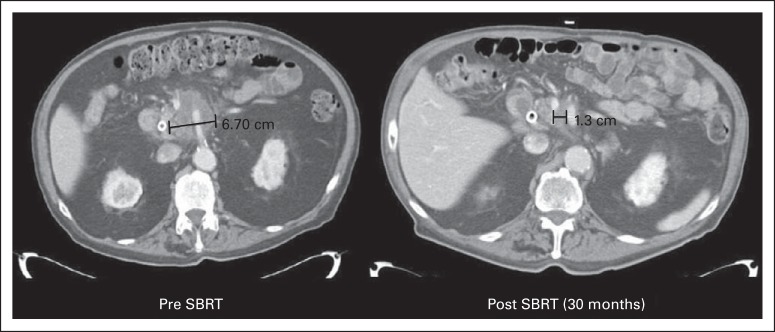 Fig 3.