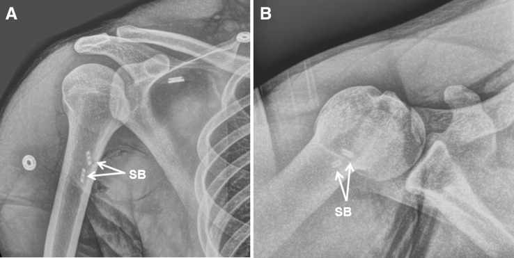 Fig 7