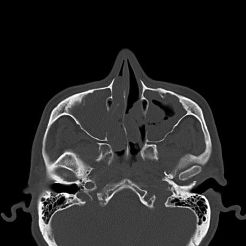 Fig. 5