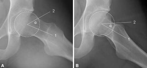 Fig. 3A–B