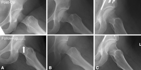 Fig. 4A–C