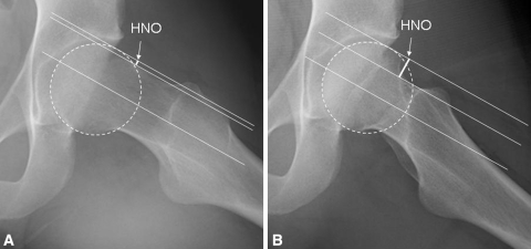 Fig. 2A–B