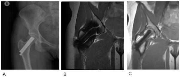 Figure 17