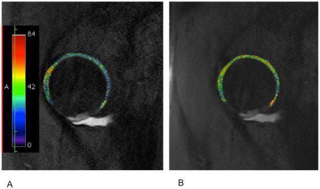 Figure 13