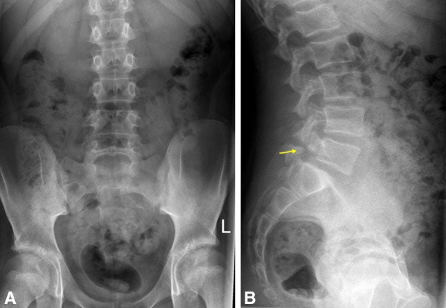 Fig. 2A–B