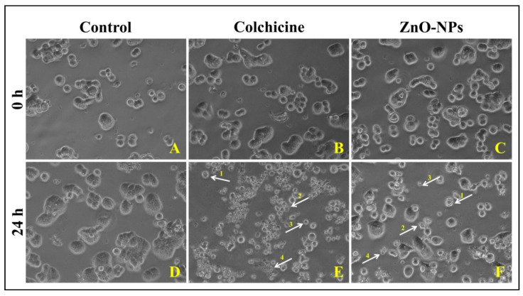 Figure 12