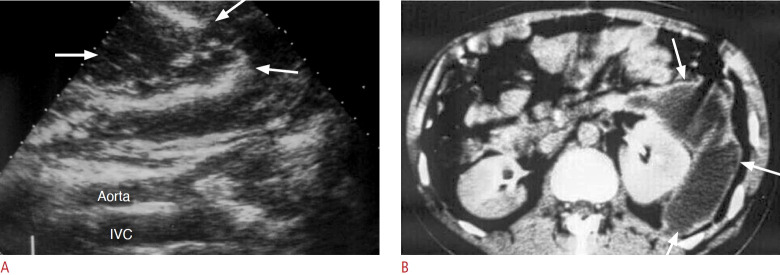 Fig. 11.