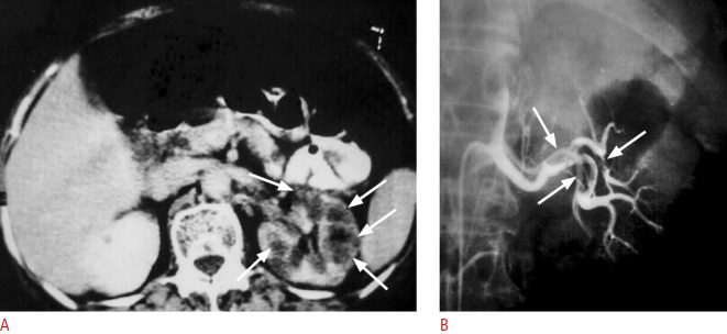 Fig. 21.