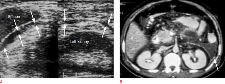 Fig. 10.