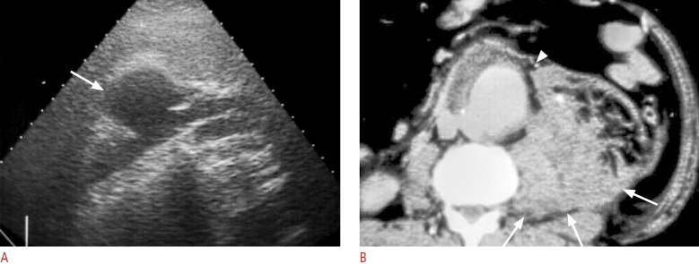 Fig. 13.