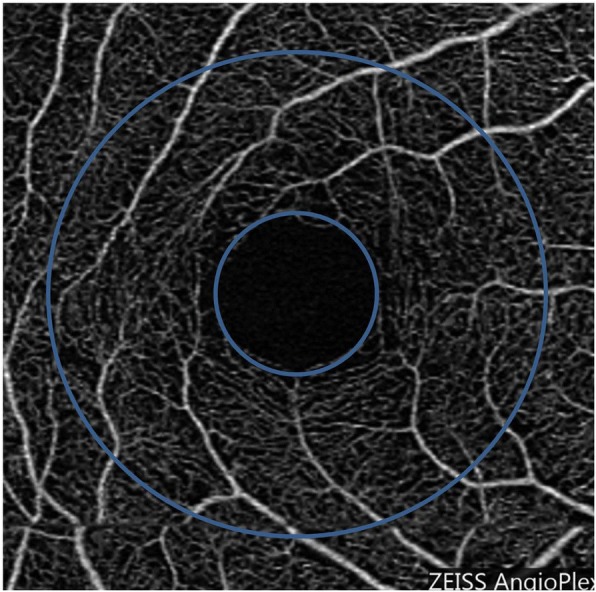 Fig. 3