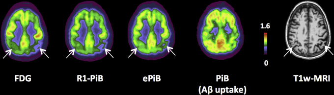 Fig. 1