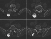 Fig. 3