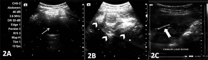 Figure 2: