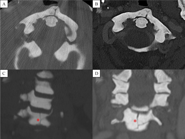 Fig.1