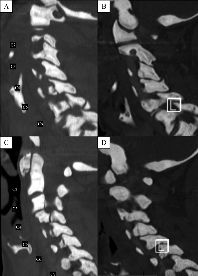 Fig.2