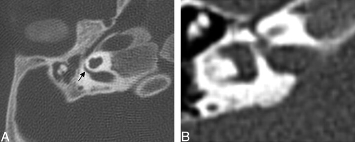 Fig. 10.