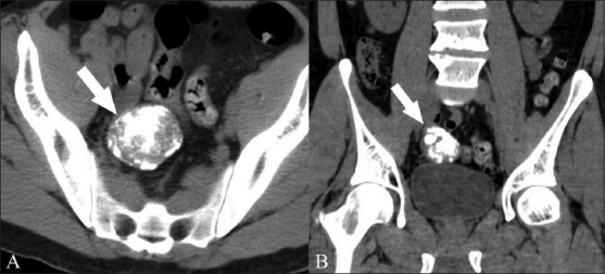 Figure 1 (A,B)