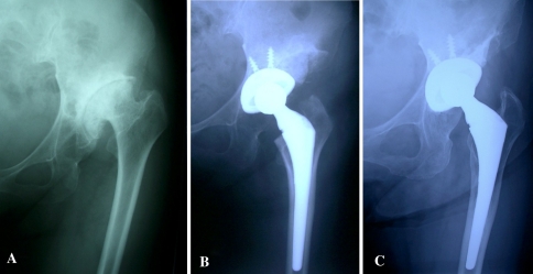 Fig. 5A–C