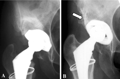 Fig. 7A–B