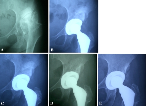 Fig. 6A–E