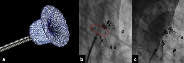 Fig 2