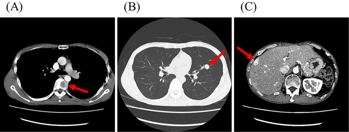 Figure 2.