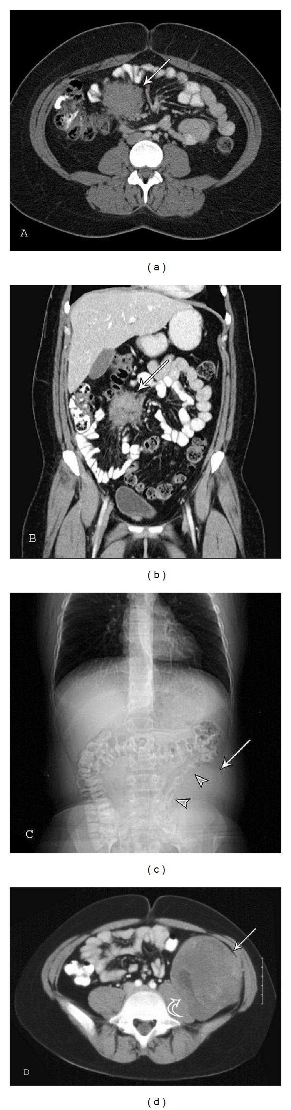 Figure 11