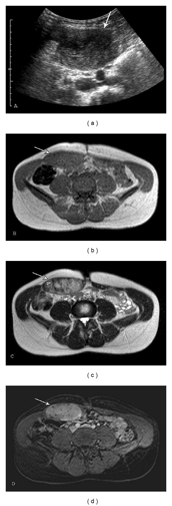 Figure 9