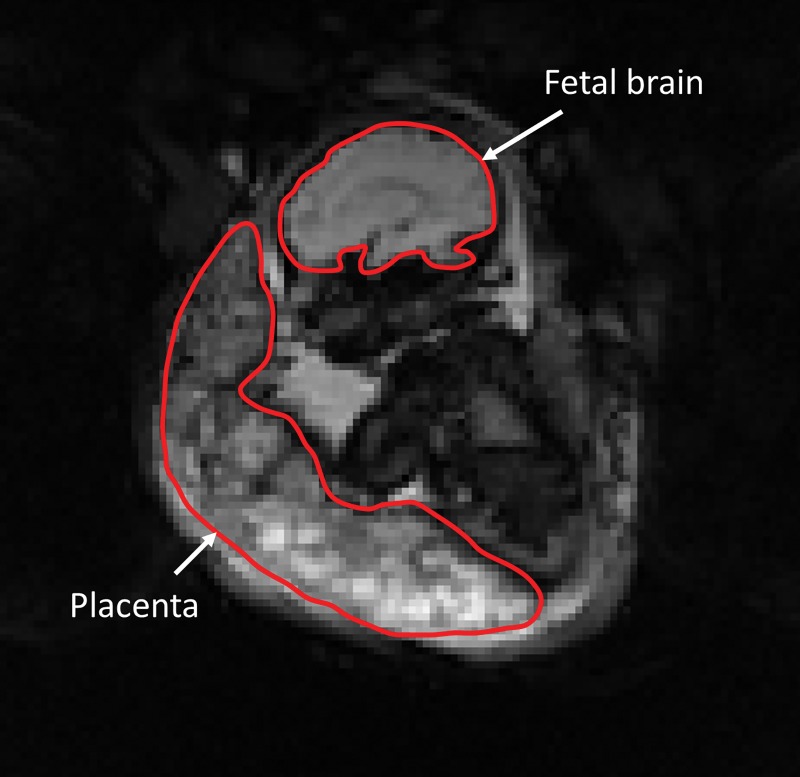 Figure 2: