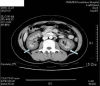 Fig. 2