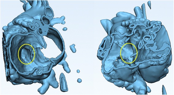 Fig. 18