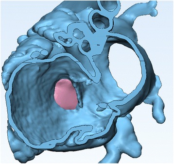 Fig. 28