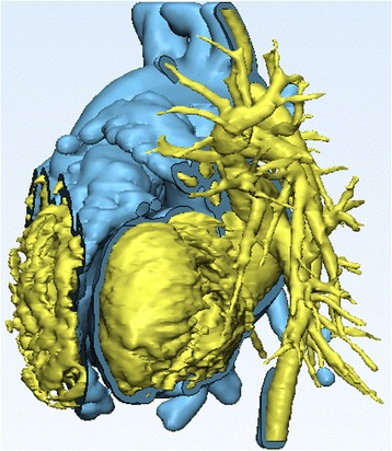 Fig. 17