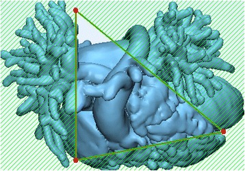 Fig. 16