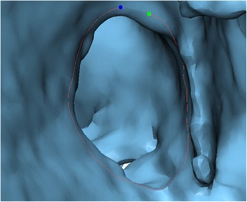 Fig. 21