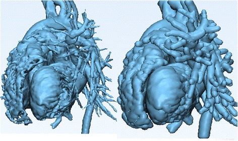 Fig. 14